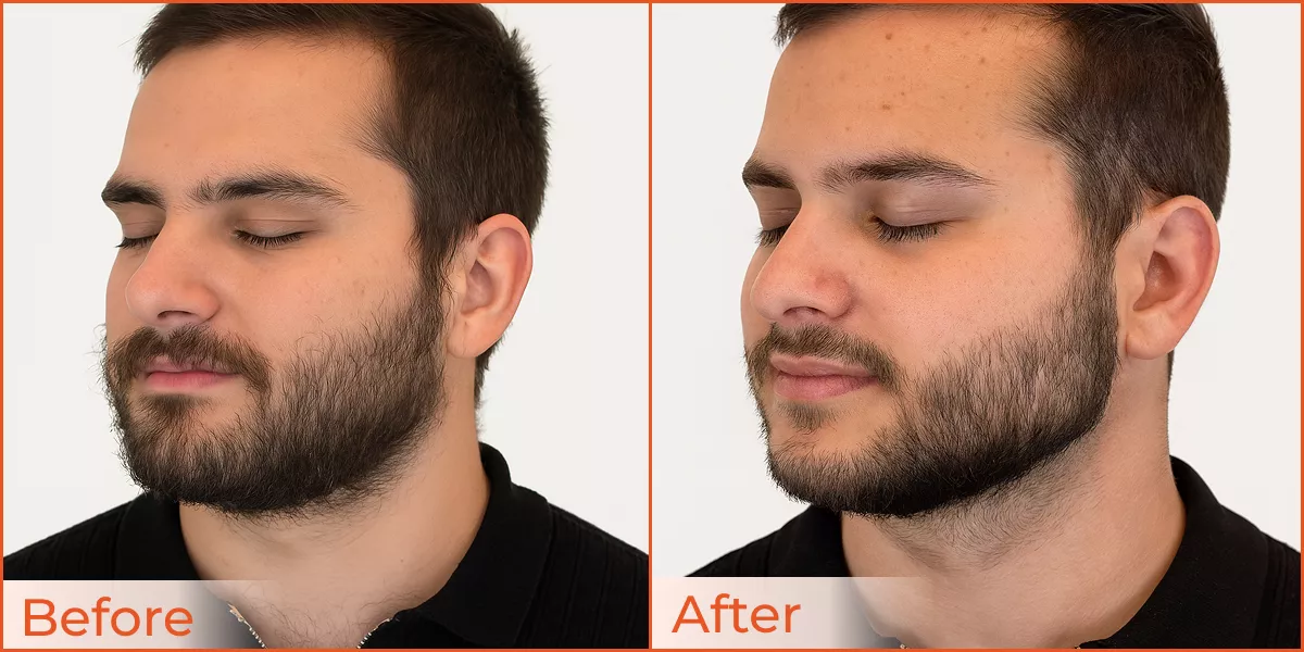 Beard Shaping