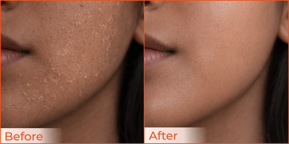 Improved Hydration & Barrier