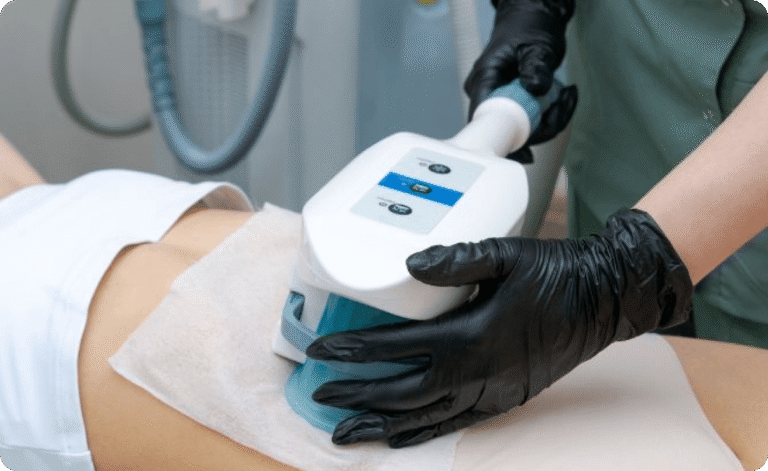 CoolSculpting-fat