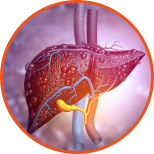 fatty-liver-2